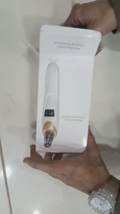 Electric Blackhead Remover | Vacuum Acne & Pore Cleaner | 5 Heads Suction Machine | Skin Care & Exfoliating Tool